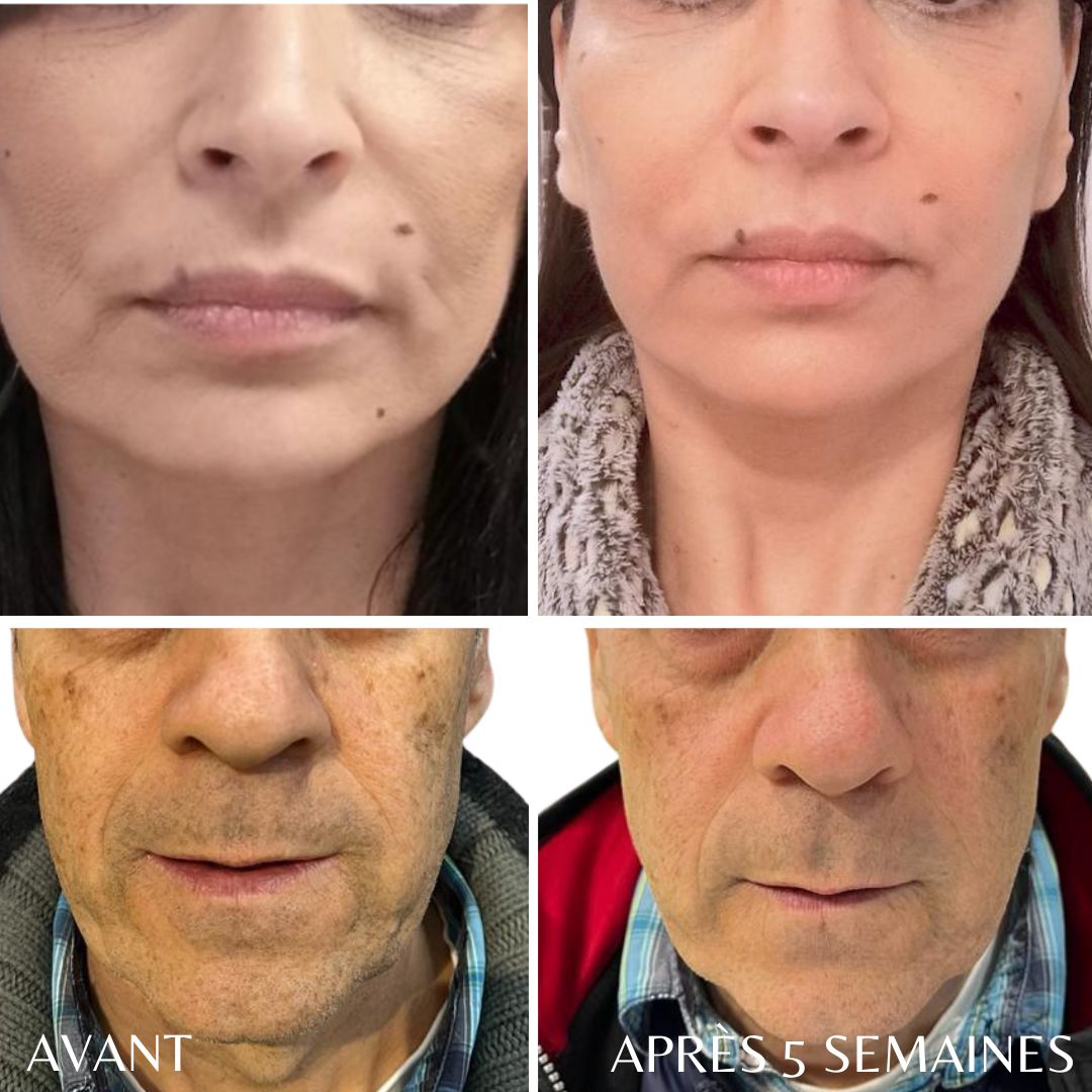 avant apres (23)